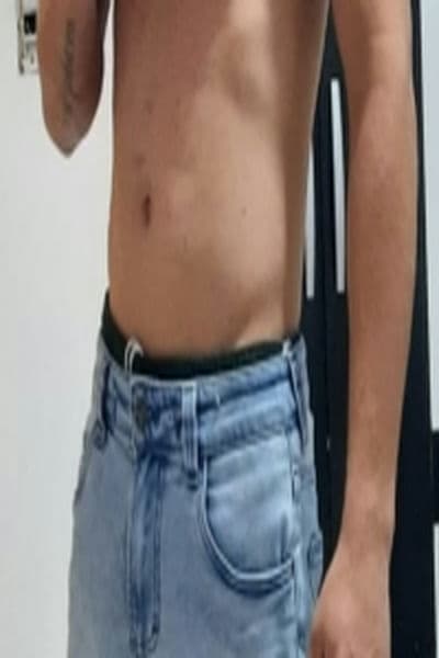 Garoto veneno